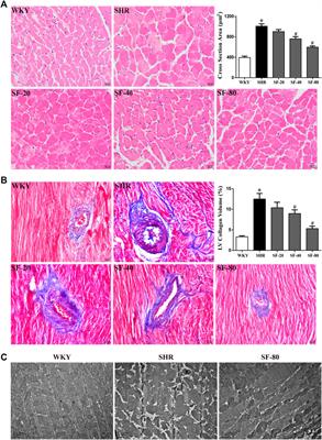 Effects of Sodium Ferulate on Cardiac Hypertrophy Are via the CaSR-Mediated Signaling Pathway